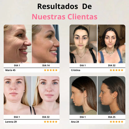 Nuevo GlowLift Pro